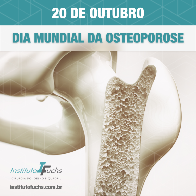 Fator Que Favorece O Surgimento Da Osteoporose