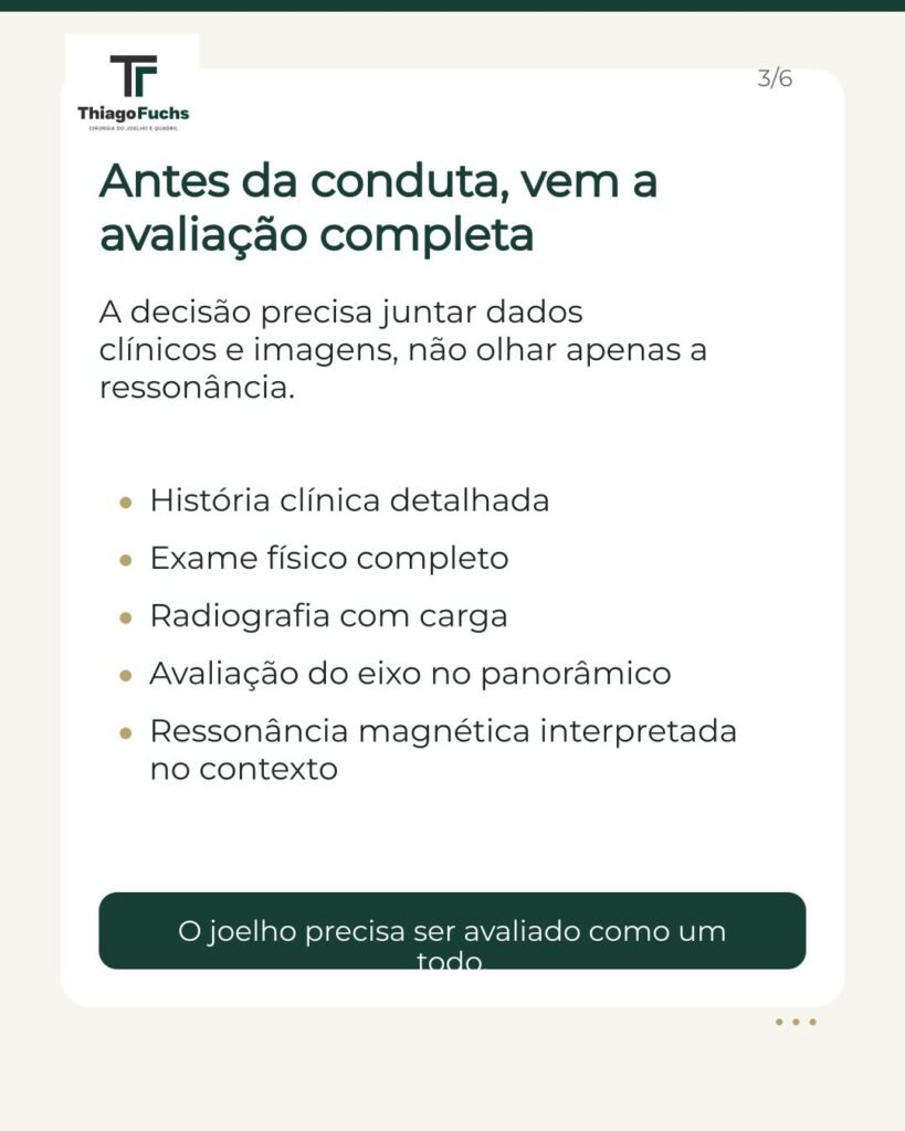 Antes da conduta, vem a avaliação completa: história clínica detalhada, exame físico completo, radiografia com carga, avaliação do eixo no panorâmico e ressonância magnética interpretada no contexto.