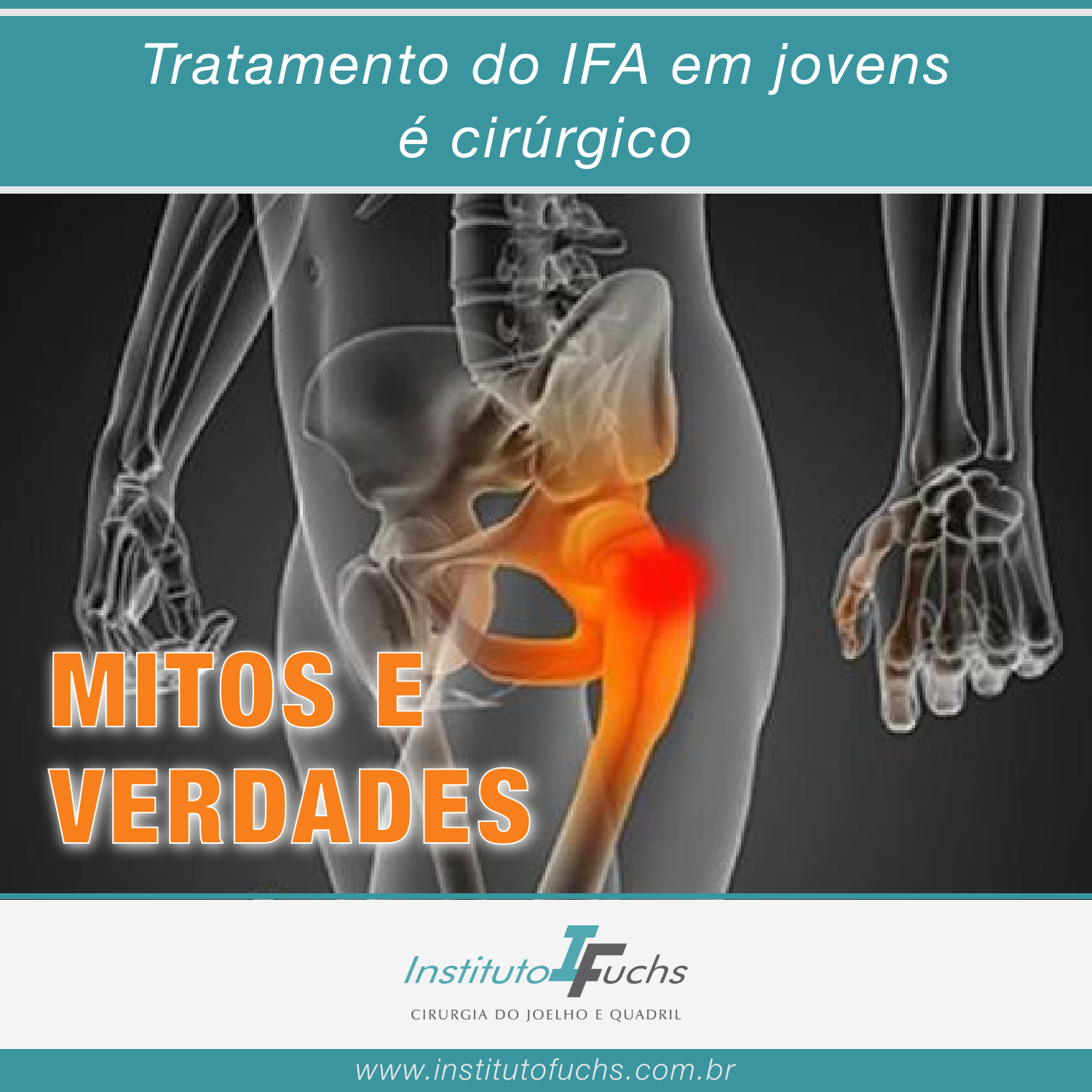 MITOS_E_VERDADES_-_04_-_Tratamento_do_IFA_em_jovensé_cirúrgico